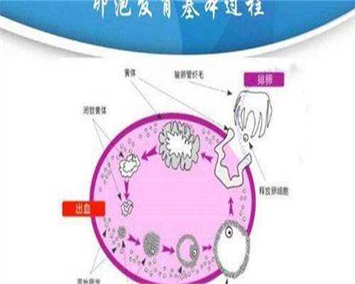 卵泡不破是什么原因造成的？卵泡不会破怎么回事？