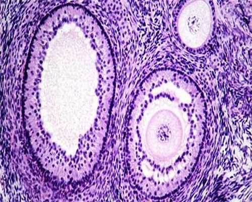 子宫内膜厚先别刮宫，这6种治疗方案同样有效！