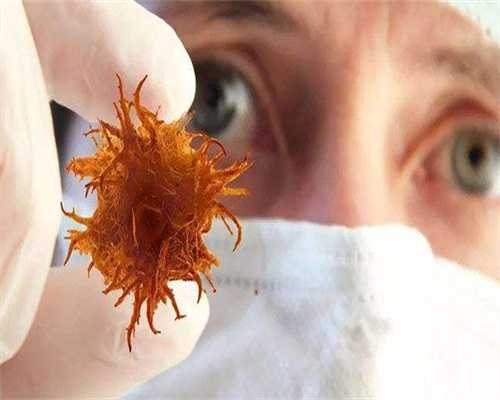 移植后黄金48小时是什么意思？