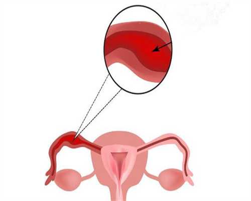 供卵机构助孕:子宫畸形影响生育吗？子宫畸形都有哪些危害？