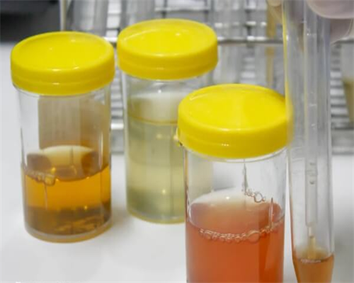 amh和基础卵泡不匹配amh低但是卵泡有10个