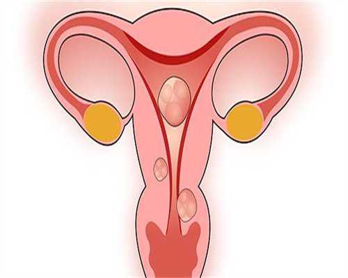 试管捐卵代怀-备孕不能吃大蒜吗，备孕期间能吃大蒜吗