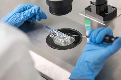 代孕成功几率-宫腔少量积液是什么意思