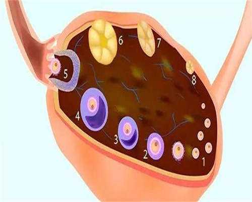 做完宫腔镜后多久可以备孕