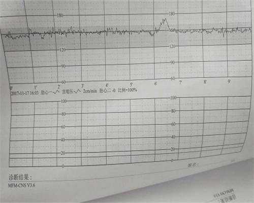 供卵代孕机构-孕期血糖多高需要打胰岛素