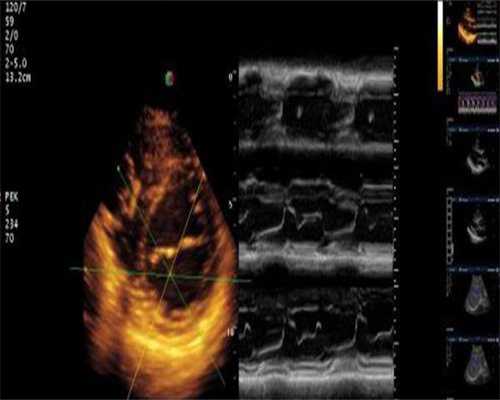 代生网选性别:妊娠反应怎样过去的快？妊娠反应怎么形成的？
