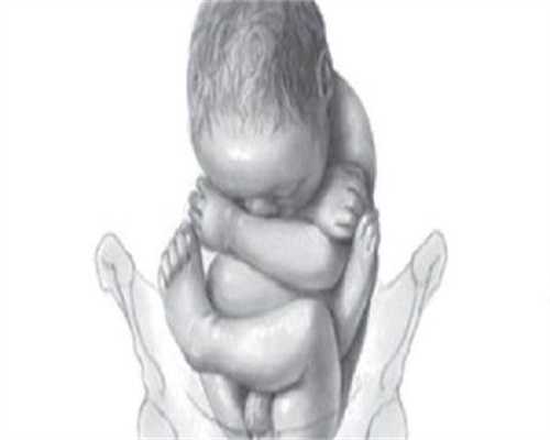 代孕产子医院-优势卵泡不排怎么办、打促排针又过敏