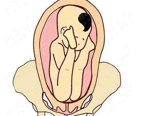 下午的尿用验孕纸验孕准确吗（月经推迟几天可以验孕）