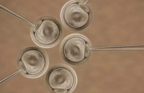 拉萨试管婴儿费用多少