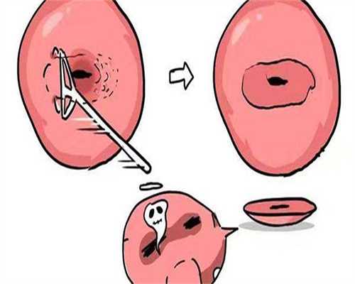 专业代生子-怀孕七周孕酮多少正常-怀孕7周孕酮24正常么