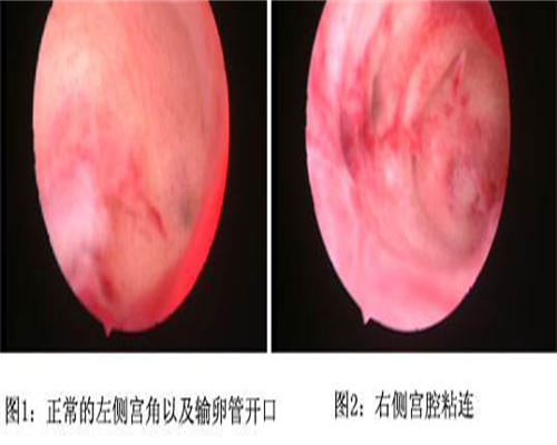 「怀孕初期为什么查凝血四项」孕妇查凝血是检查什么