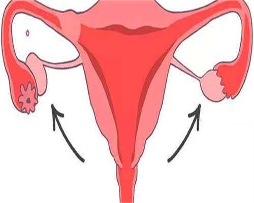 试管代怀套餐-温州始基子宫有卵巢能做试管吗，详解子宫畸形做试管要满足条件