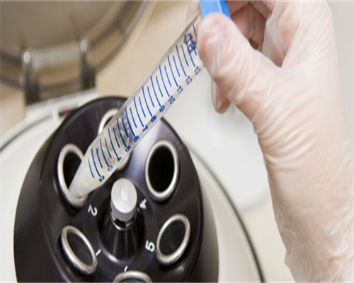 34岁排卵期疼痛是患了腺肌症吗？