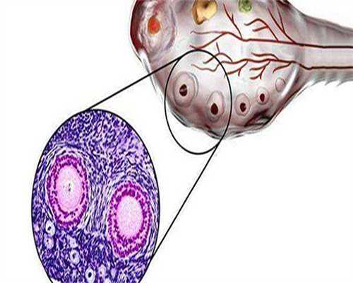 孕妇能吃阿莫西林吗_孕妇吃阿莫西林的正确方法