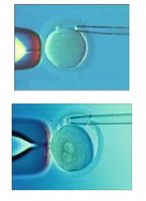 代孕宝宝地址-长期吃炒过的黑豆对卵泡发育有好处吗？