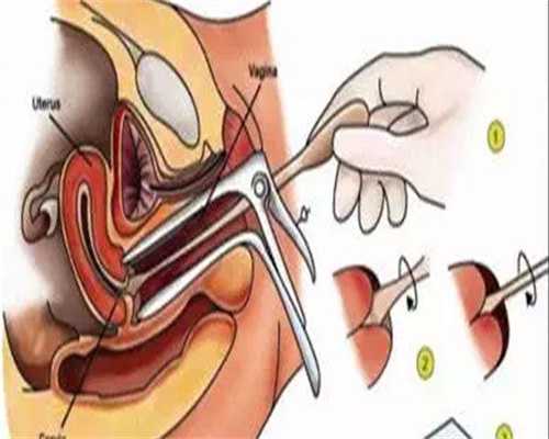 代生费用排名:人工授精挑选优质精子，人工受孕是否可以挑选优质的精子进行受精？