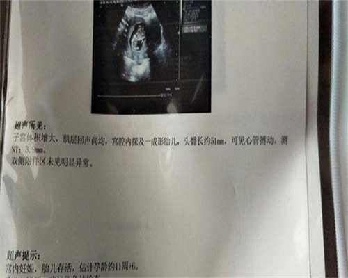 垂体瘤内分泌治疗效果如何