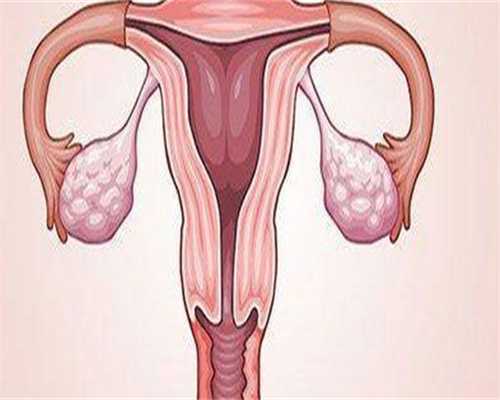 代怀助孕机构-促排卵药物能否报销促排卵可以医保报销么