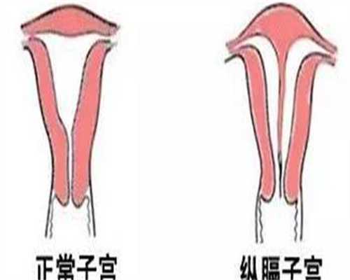 试管婴儿能自由选择双胎龙凤胎吗?
