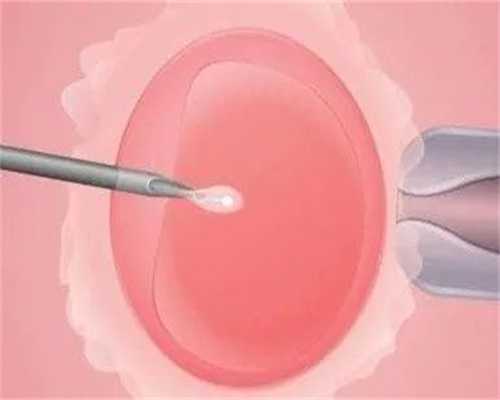 三代试管可以挑选优质精子？
